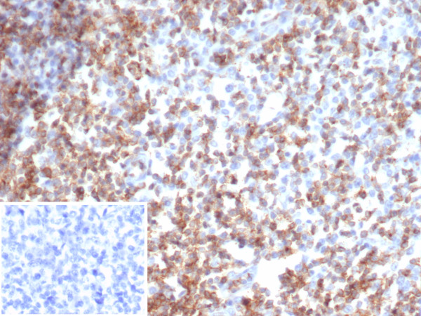 Anti-CD2 / Lymphocyte Function Antigen 2 (LFA-2), recombinant antibody, clone rLFA2/7147