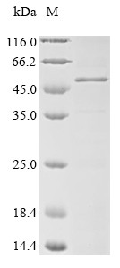Melanoma-associated antigen 3 (MAGEA3), human, recombinant