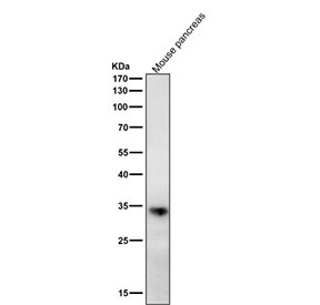 Anti-ERP27 / Endoplasmic reticulum resident protein 27 / TXNDC13, clone 32E24