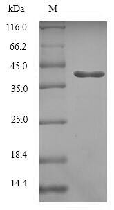Ras-related protein Rab-5C (RAB5C), human, recombinant