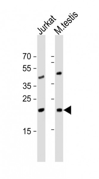 Anti-ORMDL3