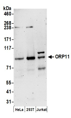 Anti-ORP11