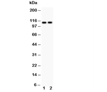 Anti-ATP2A3
