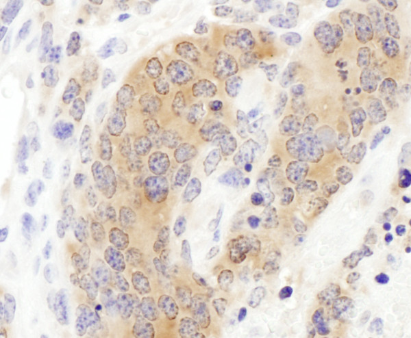 Anti-CCT3
