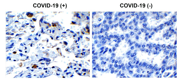 Anti-SARS-CoV-2 Envelope protein