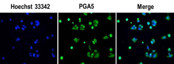 Anti-PGA5, clone SQab18120