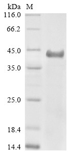 Serine--pyruvate aminotransferase (AGXT), human, recombinant