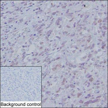 Anti-Myoblast Determination Protein 1
