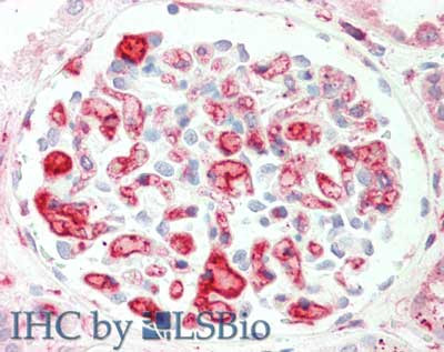 Anti-Apolipoprotein C-II (Apo C-II)