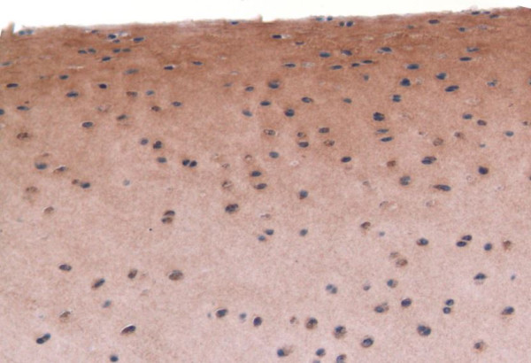Anti-Collagen II