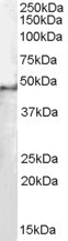 Anti-SF3B4 / SAP49, N-terminal