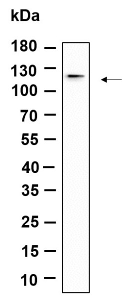 Anti-Recombinant DDR1, clone 11A9