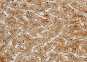Anti-C5a/Complement 5a Monoclonal Recombinant Antibody