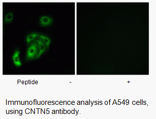 Anti-CNTN5