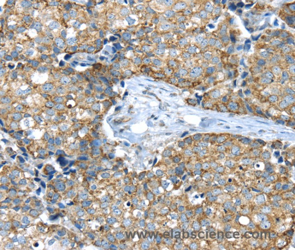 Anti-IFNA2