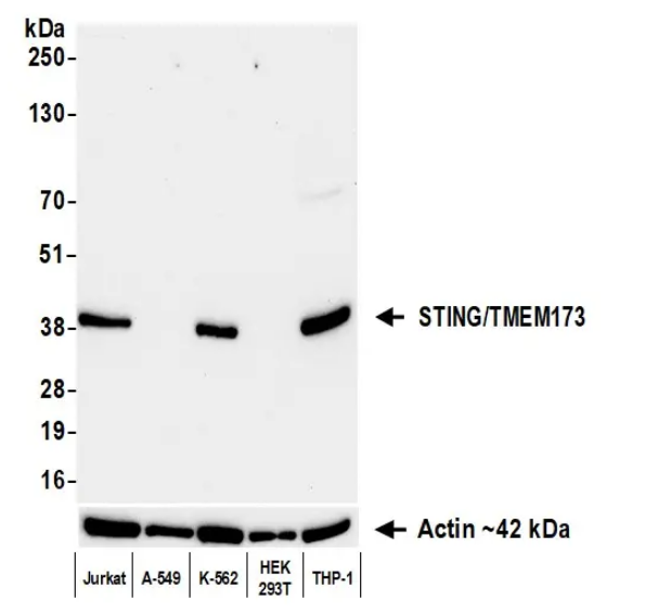 Anti-STING/TMEM173 Recombinant Monoclonal