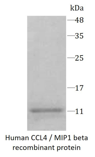 Human CCL4 / MIP1 beta recombinant protein (Active)