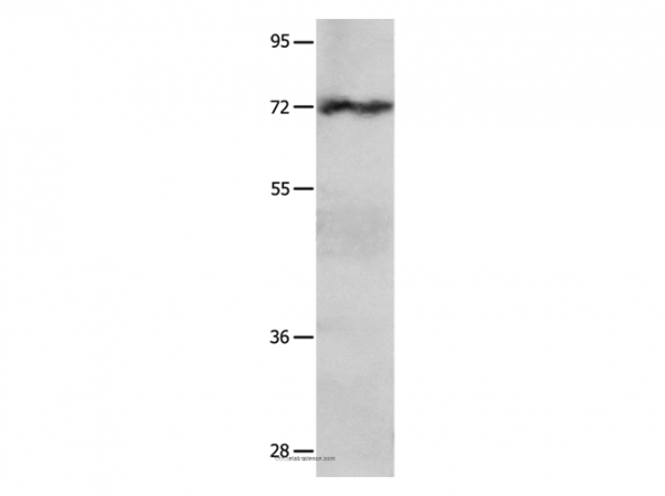 Anti-IGF2BP1