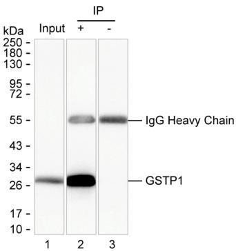 Anti-GSTP1