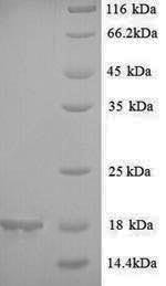 2S seed storage albumin protein, Glycine max, recombinant