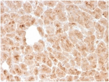 Anti-LMO2 / Rhombotin 2, clone rLMO2/1971