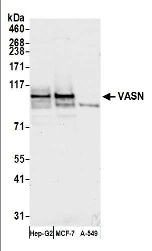 Anti-VASN