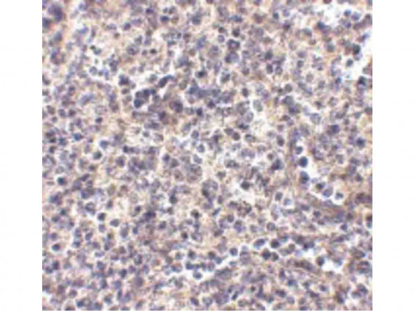 Anti-ATG5