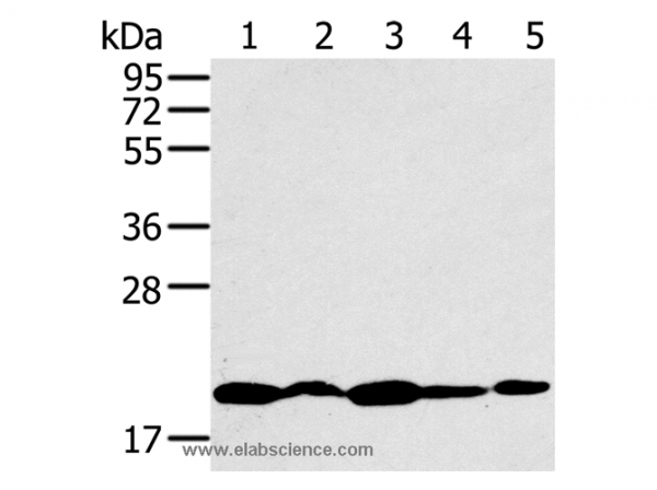 Anti-RNF5
