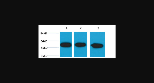 Anti-beta III tubulin, monoclonal