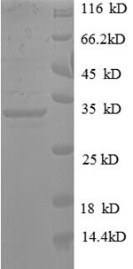 Pyrroline-5-carboxylate reductase 1, mitochondrial (PYCR1), human, recombinant