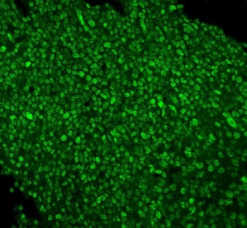 Anti-PTBP1, clone 3H12