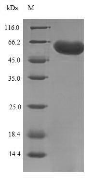 F-box/LRR-repeat protein 2 (FBXL2), human, recombinant