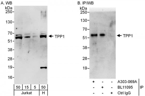Anti-TPP1