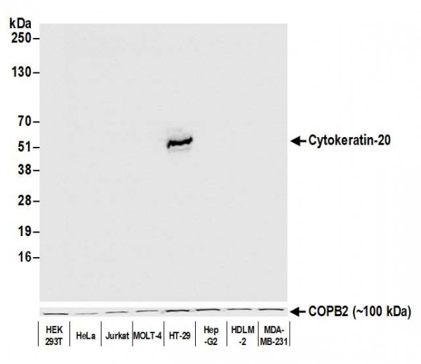 Anti-Cytokeratin 20 Recombinant Monoclonal