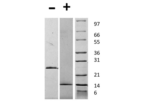 Growth and Differentiation Factor-15