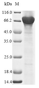 Nuclear receptor ROR-gamma (RORC), human, recombinant