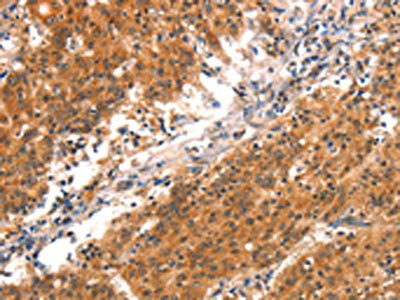 Anti-BCL3