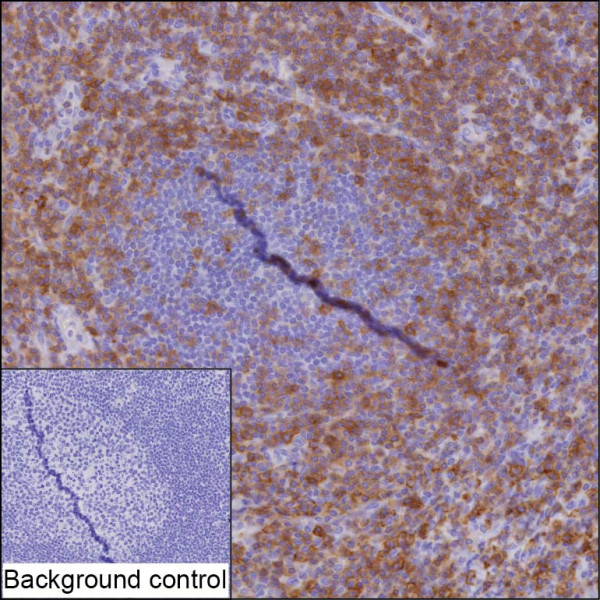 Anti-CD27