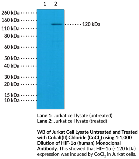 Anti-HIF-1alpha (human) Monoclonal Antibody (Clone RM242)