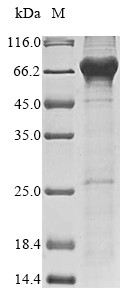 Inactive N-acetylated-alpha-linked acidic dipeptidase-like protein 2 (NAALADL2), partial, human, rec