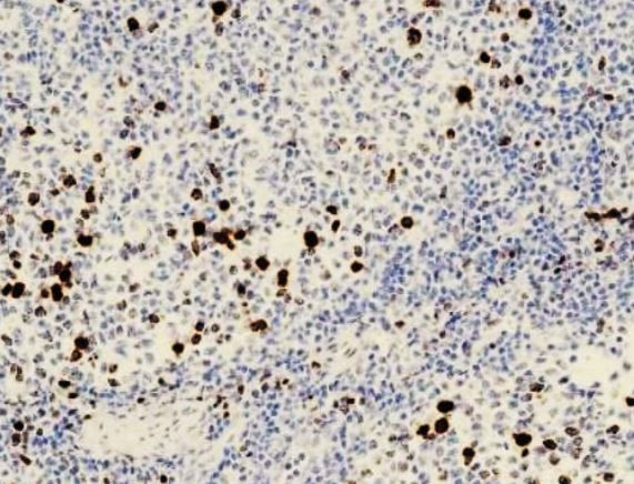 Anti-phospho-Histone H3 (Ser10), clone SQab20186