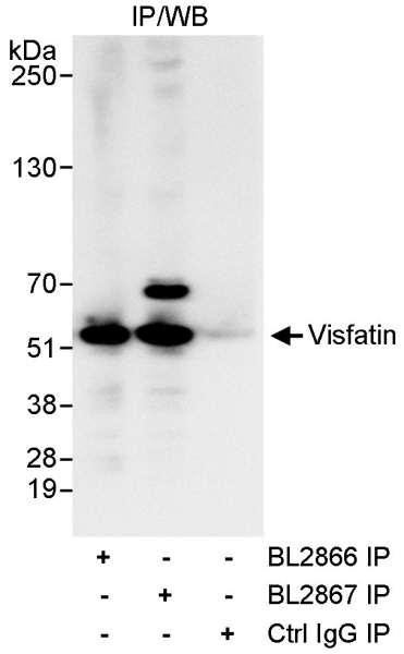 Anti-Visfatin