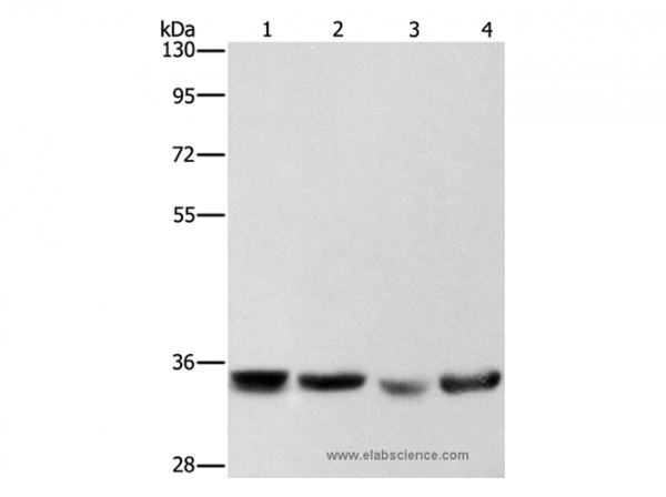 Anti-AIMP1