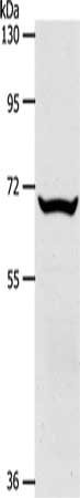 Anti-SLC33A1