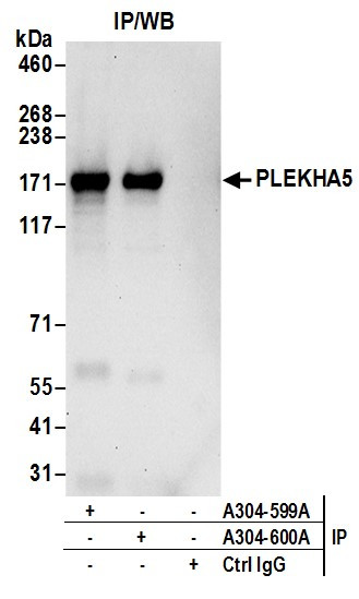 Anti-PLEKHA5