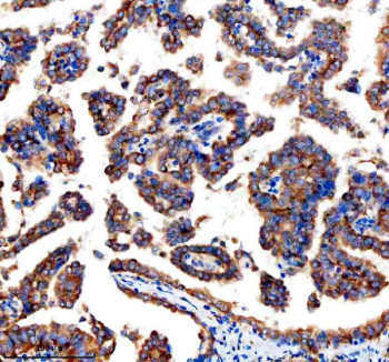 Anti-ARHGEF2 / Rho guanine nucleotide exchange factor 2 / GEF-H1
