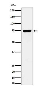 Anti-DBH / Dopamine beta Hydroxylase, clone 31D18