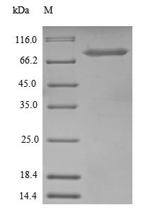 Nucleolar transcription factor 1 (UBTF), partial, human, recombinant