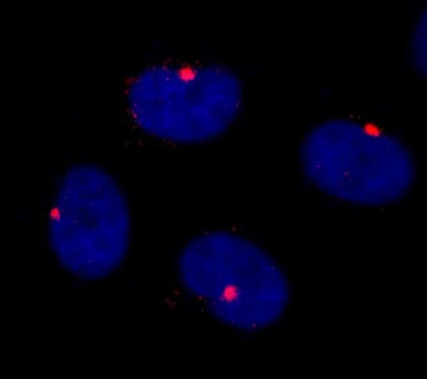 Anti-CEP290 IHC Antibody, affinity purifie (IHC)