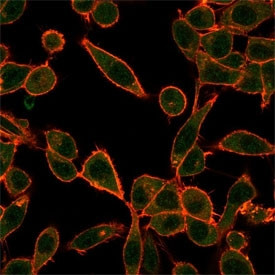 Anti-Ubiquitin-protein ligase E3A / UBE3A, clone PCRP-UBE3A-1A2